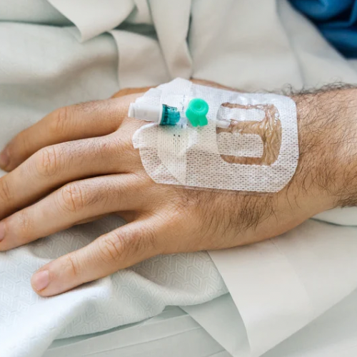 IV Cannula Insertion